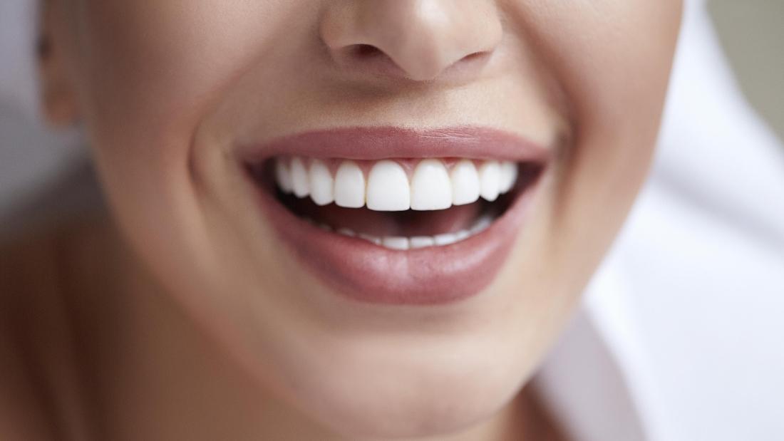 Whiten Your Teeth with OvertheCounter Products Columbus, OH