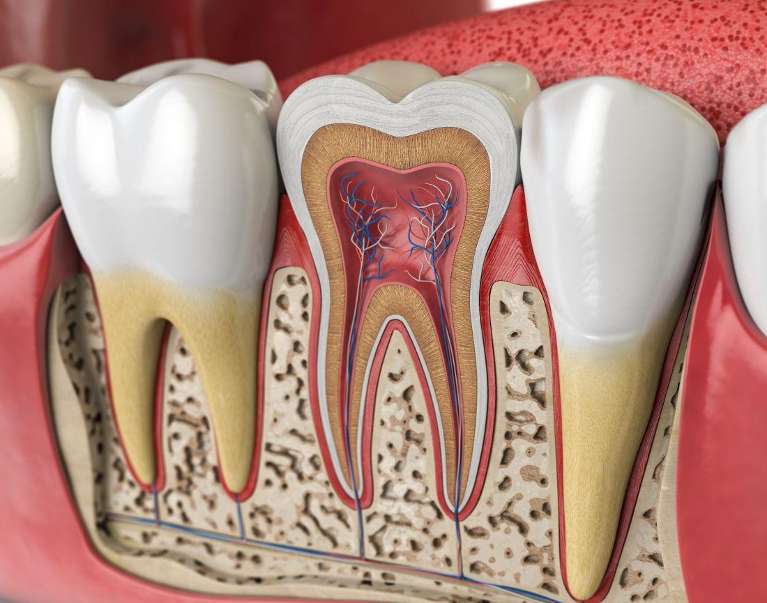 inflamed pulp and the inner root canal structure in Columbus, OH