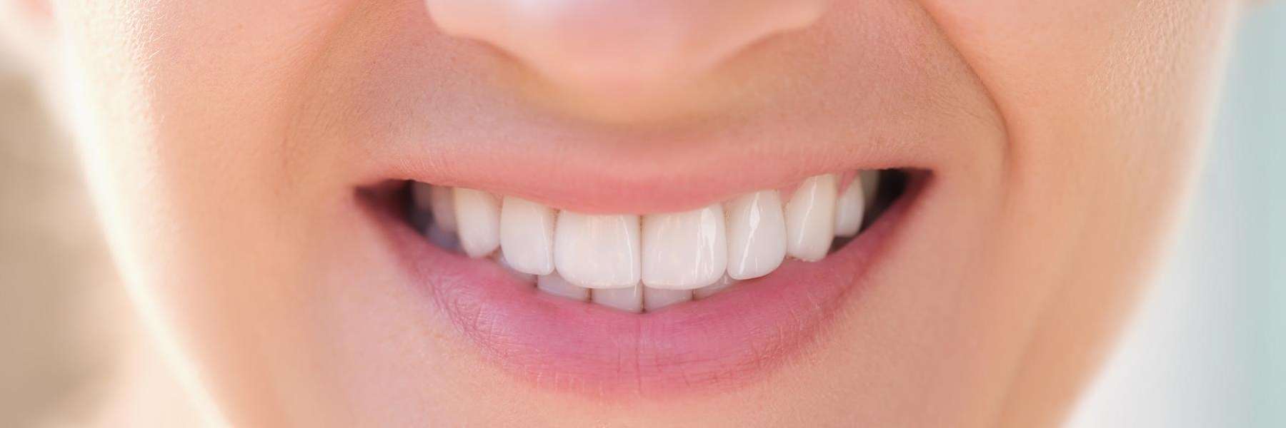 Close-up of a smiling woman with bright white teeth, showing a healthy and clean smile.