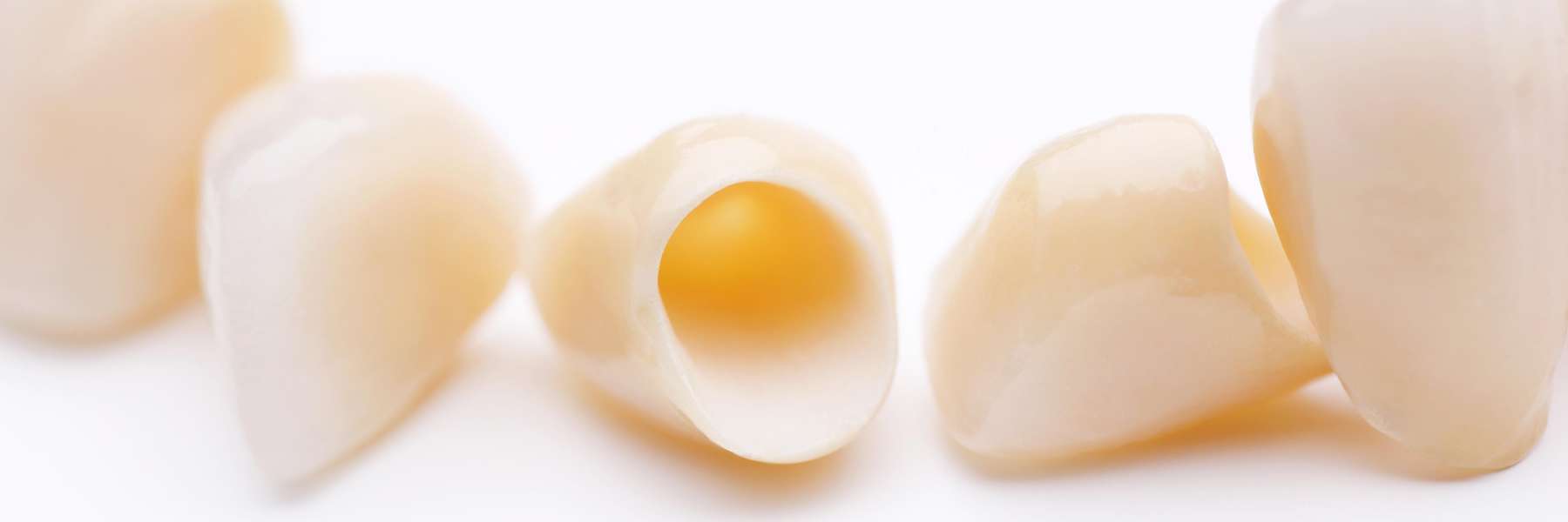 Dental crowns spread out, clintonville ohio